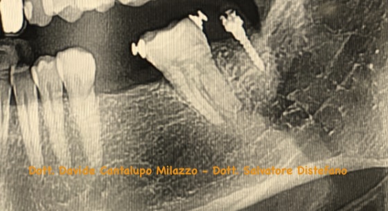 ortodonzia preprotesica distefano dentista 